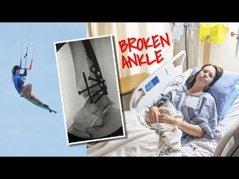 I Broke My Ankle Kiteboarding – VLOG #50